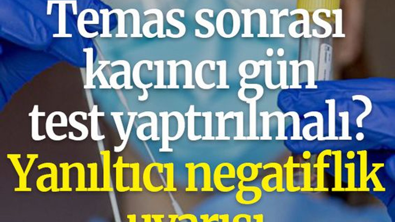 Temas sonrası kaçıncı gün test yaptırılmalı? Yanıltıcı negatiflik uyarısı